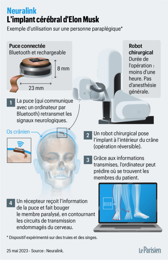 fonctionnement neuralink implant